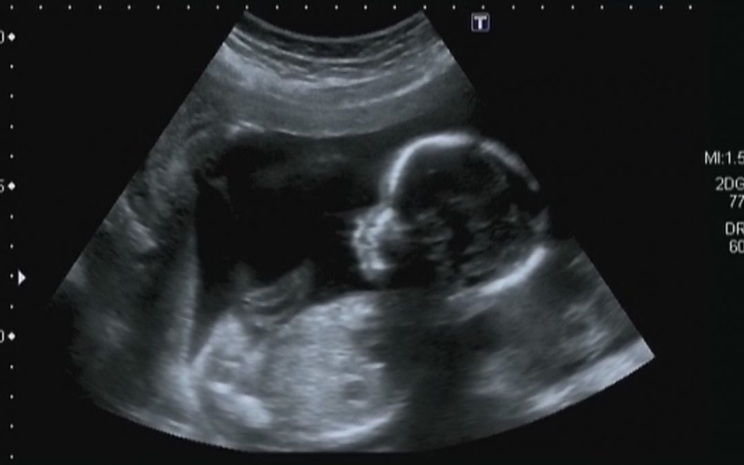 Fight for Life in 2023!