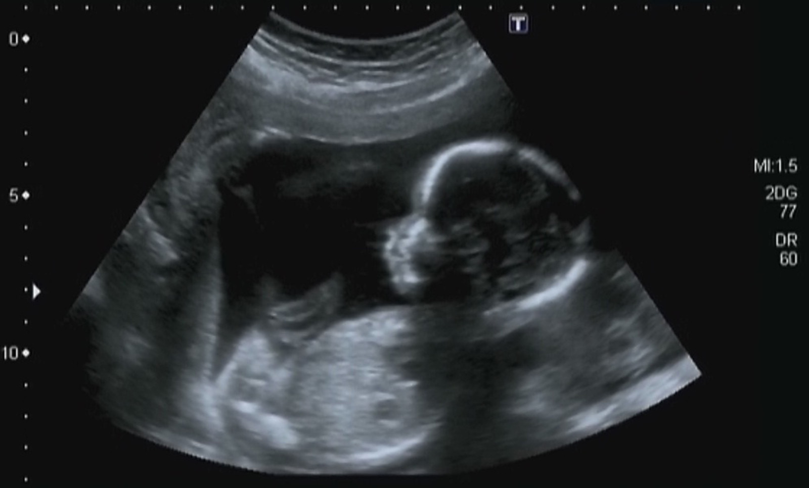 Fight for Life in 2023!